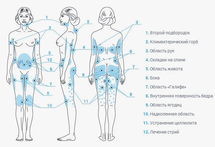 Точки гидромассажа